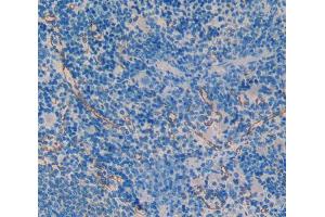 IHC-P analysis of spleen tissue, with DAB staining. (SMAD1 anticorps  (AA 273-468))