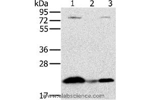 Western blot analysis of Raji cell and human liver cancer tissue, hela cell, using NDUFAF2 Polyclonal Antibody at dilution of 1:250 (NDUFAF2 anticorps)