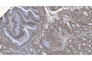 anti-Chromobox Homolog 5 (CBX5) (AA 1-191) antibody