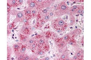 Anti-WNT11 antibody IHC of human liver.