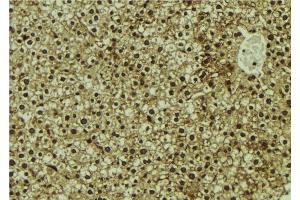ABIN6273102 at 1/100 staining Mouse liver tissue by IHC-P. (CMIP anticorps  (C-Term))