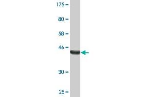 Western Blot detection against Immunogen (38. (STK3 anticorps  (AA 311-431))
