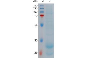 Human HAMP(60-84) Protein, hFc Tag on SDS-PAGE under reducing condition.