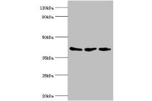 Western blot All lanes: ADP-ribosylation factor GTPase-activating protein 1 antibody at 8 μg/mL Lane 1: PC-3 whole cell lysate Lane 2: Hela whole cell lysate Lane 3: Mouse brain tissue Secondary Goat polyclonal to rabbit IgG at 1/10000 dilution Predicted band size: 45, 46, 32, 40 kDa Observed band size: 45 kDa (ARFGAP1 anticorps  (AA 1-220))