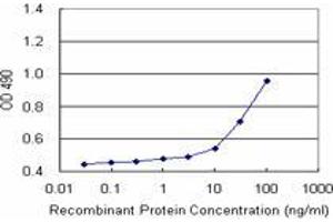Sandwich ELISA detection sensitivity ranging from 10 ng/mL to 100 ng/mL. (MCAT (Humain) Matched Antibody Pair)