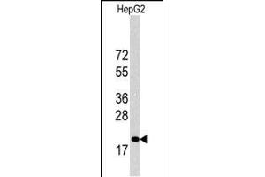 Western blot analysis of p27Kip1 Antibody (C-term) 6269b in HepG2 cell line lysates (35 μg/lane).