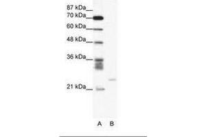 Image no. 1 for anti-BCL2-Related Protein A1 (BCL2A1) (C-Term) antibody (ABIN6736048) (BCL2A1 anticorps  (C-Term))