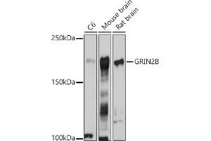 Western blot analysis of extracts of various cell lines, using GRIN2B antibody (ABIN3017275, ABIN3017276, ABIN3017277 and ABIN1680110) at 1:1000 dilution. (GRIN2B anticorps  (C-Term))