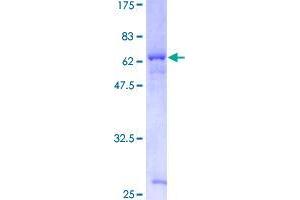 Image no. 1 for Tsukushin (TSKU) (AA 1-353) protein (GST tag) (ABIN1323898)