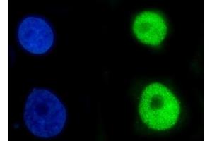 anti-Chromobox Homolog 2 (CBX2) (AA 1-532) antibody