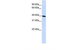 Image no. 1 for anti-Carbohydrate Kinase Domain Containing (Carkd) (AA 144-193) antibody (ABIN6738353) (Carkd anticorps  (AA 144-193))