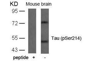 Western blot analysis of extracts from mouse brain tissue using Tau(Phospho-Ser214) Antibody and the same antibody preincubated with blocking peptide. (MAPT anticorps  (pSer214))