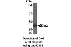Image no. 1 for anti-Deiodinase, Iodothyronine, Type III (DIO3) (AA 250-300) antibody (ABIN363667)