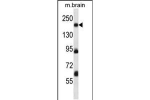 Western blot analysis in mouse brain tissue lysates (35ug/lane).