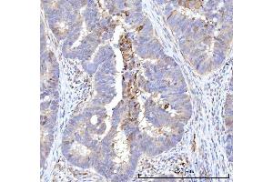 IHC analysis of RBP1 using anti-RBP1 antibody (ABIN7599586). (RBP1 anticorps  (AA 10-135))