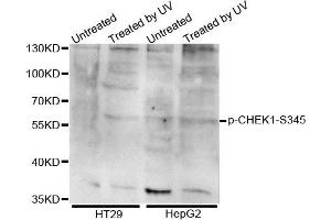 Western blot analysis of extracts of various cell lines, using Phospho-CHEK1-S345 antibody.