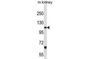 Western Blotting (WB) image for anti-Prostaglandin F2 Receptor Negative Regulator (PTGFRN) antibody (ABIN3000257) (PTGFRN anticorps)