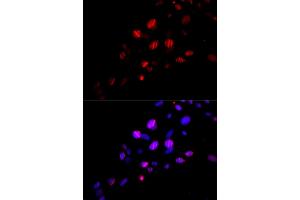Immunofluorescence analysis of U2OS cells using Rad18 antibody (ABIN6128609, ABIN6146628, ABIN6146630 and ABIN6217430). (RAD18 anticorps  (AA 216-495))