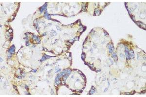 Immunohistochemistry of paraffin-embedded Human placenta using ECH1 Polyclonal Antibody at dilution of 1:150 (40x lens).