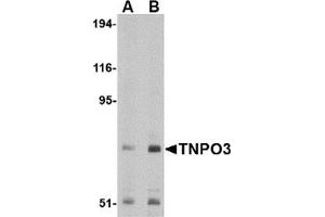 Western blot analysis of TNPO3 in Raji cell lysate with TNPO3 antibody at (A) 1 and (B) 2 μg/ml. (Transportin 3 anticorps  (N-Term))