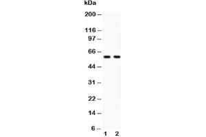 Western blot testing of Src antibody and Lane 1:  COLO320;  2: A549
