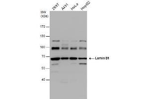 WB Image Lamin B1 antibody detects Lamin B1 protein by western blot analysis. (Lamin B1 anticorps)