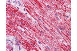 IHC Information: Paraffin embedded small intestine, muscularis propria tissue, tested with an antibody dilution of 5 ug/ml.