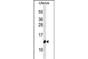 Western blot analysis in Uterus tissue lysates (35ug/lane). (TIMM10 anticorps  (AA 21-49))