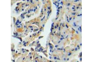 IHC-P analysis of lung tissue, with DAB staining. (TNC anticorps  (AA 174-621))