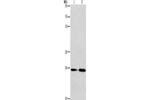 Gel: 8 % SDS-PAGE, Lysate: 40 μg, Lane 1-2: Mouse kidney tissue, Mouse liver tissue, Primary antibody: ABIN7130344(NAT8 Antibody) at dilution 1/237. (NAT8 anticorps)