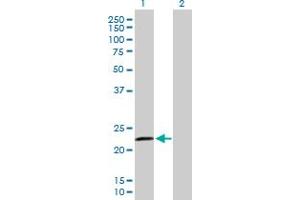 Western Blot analysis of RASGEF1B expression in transfected 293T cell line by RASGEF1B MaxPab polyclonal antibody. (RASGEF1B anticorps  (AA 1-210))