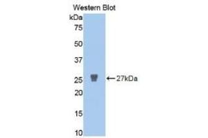 WB of Protein Standard: different control antibodies  against Highly purified E. (MMP2 Kit ELISA)