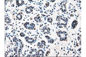 Immunohistochemical staining of paraffin-embedded breast tissue using anti-LEMD3 mouse monoclonal antibody. (LEMD3 anticorps)
