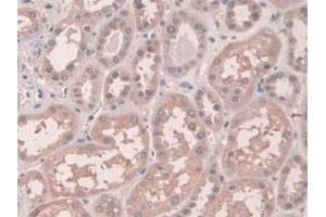 IHC-P analysis of Human Kidney Tissue, with DAB staining. (Connexin 43/GJA1 anticorps  (AA 180-382))