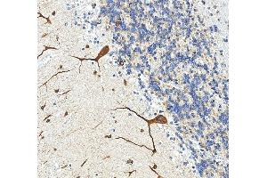 anti-Target of EGR1, Member 1 (Nuclear) (TOE1) (AA 28-501) antibody