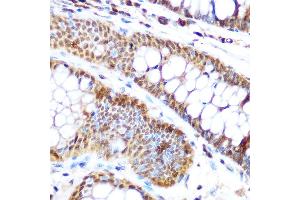 Immunohistochemistry of paraffin-embedded human colon using SP3 Rabbit pAb (ABIN6130701, ABIN6148314, ABIN6148315 and ABIN6216542) at dilution of 1:100 (40x lens). (Sp3 anticorps  (AA 240-350))