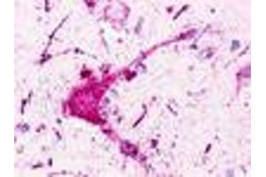 Anti-P2RY1 / P2Y1 antibody IHC of human brain, neurons and glia.