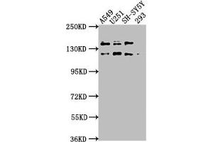 Western Blot Positive WB detected in: A549 whole cell lysate, U251 whole cell lysate, SH-SY5Y whole cell lysate, 293 whole cell lysate All lanes: TAOK1 antibody at 1:2000 Secondary Goat polyclonal to rabbit IgG at 1/50000 dilution Predicted band size: 117, 47, 98 kDa Observed band size: 117 kDa (TAO Kinase 1 (TAOK1) (AA 400-659) anticorps)