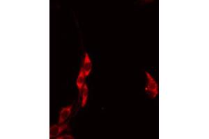 ABIN6274612 staining HeLa by IF/ICC. (HCCS anticorps  (Internal Region))