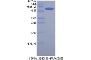 SDS-PAGE analysis of Human KIR3DL2 Protein. (KIR3DL2 Protéine)