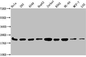 Western Blot Positive WB detected in: Hela whole cell lysate, 293 whole cell lysate, A549 whole cell lysate, HepG2 whole cell lysate, Jurkat whole cell lysate, K562 whole cell lysate, HL60 whole cell lysate, MCF-7 whole cell lysate, LO2 whole cell lysate All lanes: HIST1H1C antibody at 1:500 Secondary Goat polyclonal to rabbit IgG at 1/40000 dilution Predicted band size: 22 kDa Observed band size: 22 kDa (HIST1H1C anticorps  (meLys186))