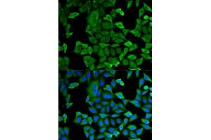Immunofluorescence analysis of MCF-7 cells using GAPDH antibody. (GAPDH anticorps  (AA 1-335))
