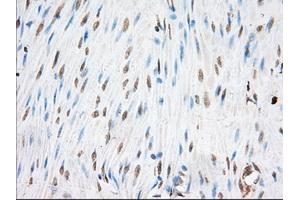 Immunohistochemical staining of paraffin-embedded Human colon tissue using anti-EIF2S1 mouse monoclonal antibody. (EIF2S1 anticorps)