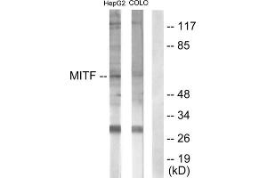 Western blot analysis of extracts from HepG2 cells (lane 1) and COLO205 cells (lane 2), using MITF (epitope around residue 180/73) antibody. (MITF anticorps  (Ser73, Ser180))