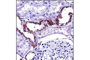 MCOLN1 Antibody (C-term) ((ABIN657474 and ABIN2846502))immunohistochemistry analysis in formalin fixed and paraffin embedded human kidney tissue followed by peroxidase conjugation of the secondary antibody and DAB staining. (MCOLN1 anticorps  (C-Term))