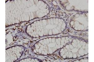 Image no. 2 for anti-CDK5 Regulatory Subunit Associated Protein 3 (CDK5RAP3) (AA 1-507) antibody (ABIN599311) (CDK5RAP3 anticorps  (AA 1-507))