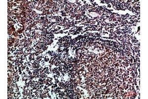 Immunohistochemical analysis of paraffin-embedded Human-tonsil, antibody was diluted at 1:100 (IL17D anticorps  (AA 141-190))