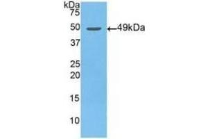 Detection of Recombinant NSE, Human using Polyclonal Antibody to Enolase, Neuron Specific (NSE) (ENO2/NSE anticorps  (AA 2-285))