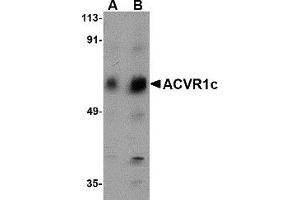 Western Blotting (WB) image for anti-Activin Receptor Type 1C (ACVR1C) (N-Term) antibody (ABIN1031213) (ACVR1C/ALK7 anticorps  (N-Term))