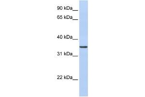 WB Suggested Anti-CDC42EP4 Antibody Titration: 0.